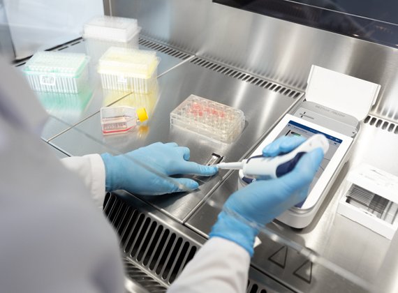 梅特勒托利多推出CytoDirect免染色自动细胞计数仪